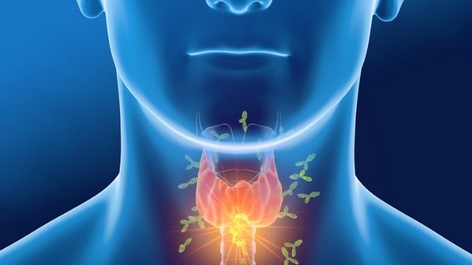 Antibodies attacking thyroid gland