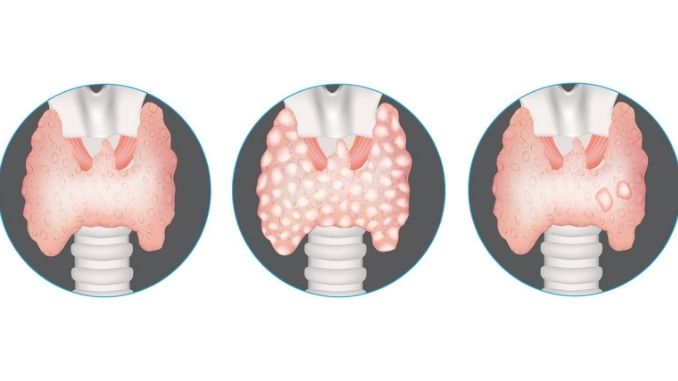 gland diseases