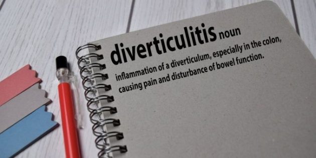 A Closer Look at Acidophilus Understanding Diverticulitis - Is There a Treatment