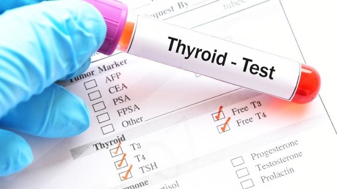 Thyroid hormone test