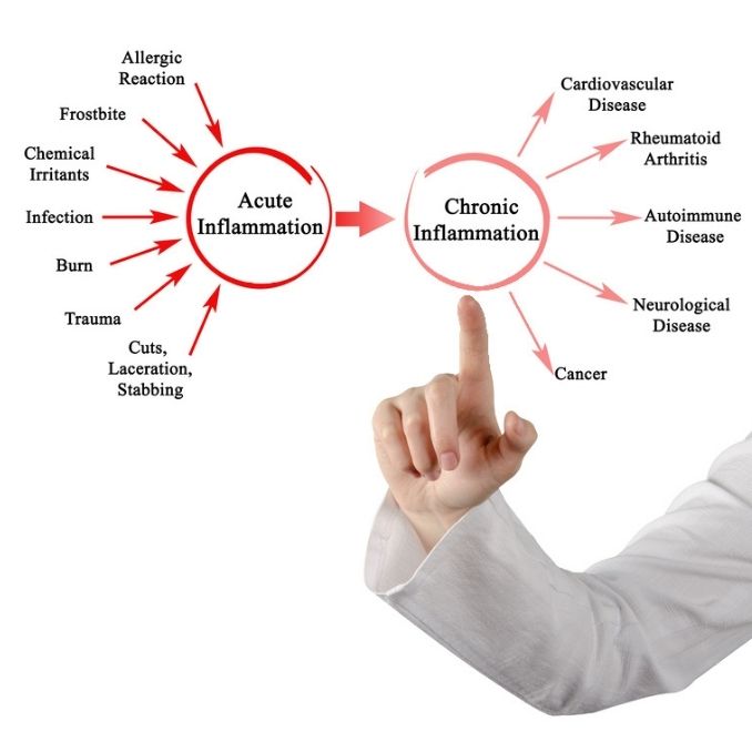 Acute and Chronic Inflammation