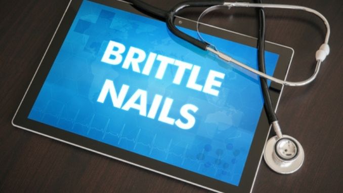 Brittle nails