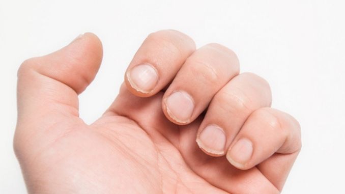 Why Do I Have Brittle Nails? - PainLess Nutritionals