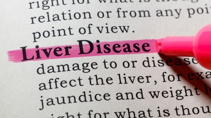 Liver Disease Signs And Symptoms-liver-disease-dictionary-word