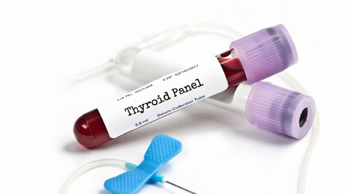 Thyroid Panel Lab Sample