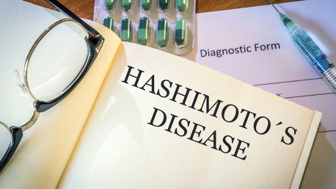book diagnosis Hashimoto disease