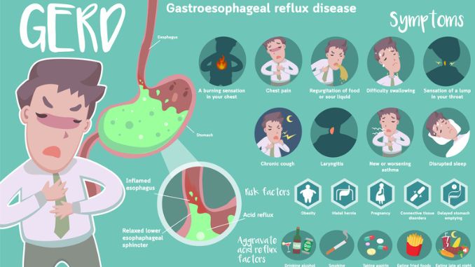 gastroesophageal-reflux-disease